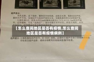 【怎么查阅地区是否有疫情,怎么查阅地区是否有疫情病例】