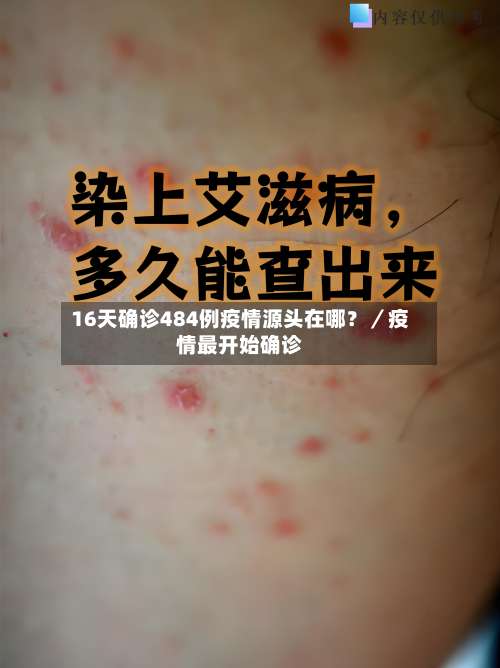 16天确诊484例疫情源头在哪？／疫情最开始确诊-第1张图片