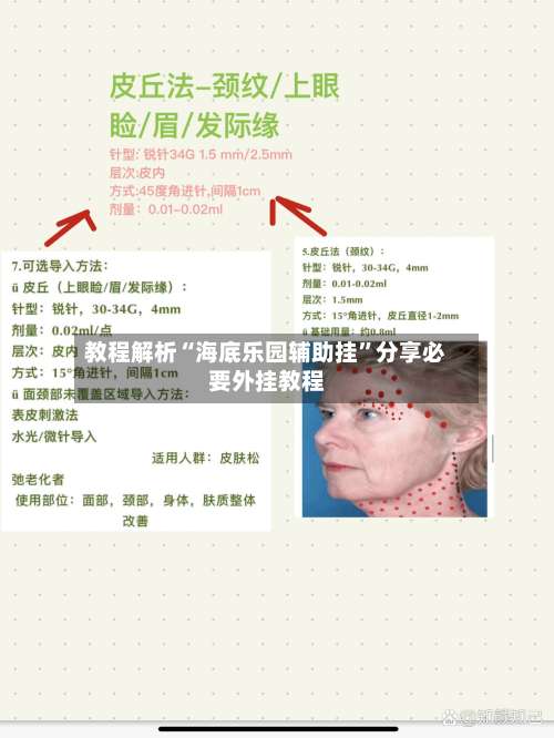 教程解析“海底乐园辅助挂	”分享必要外挂教程-第2张图片