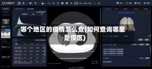 哪个地区的疫情怎么查(如何查询哪里是疫区)-第2张图片